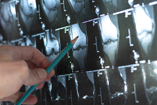 A photo on an x-ray.