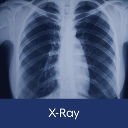 X-Ray